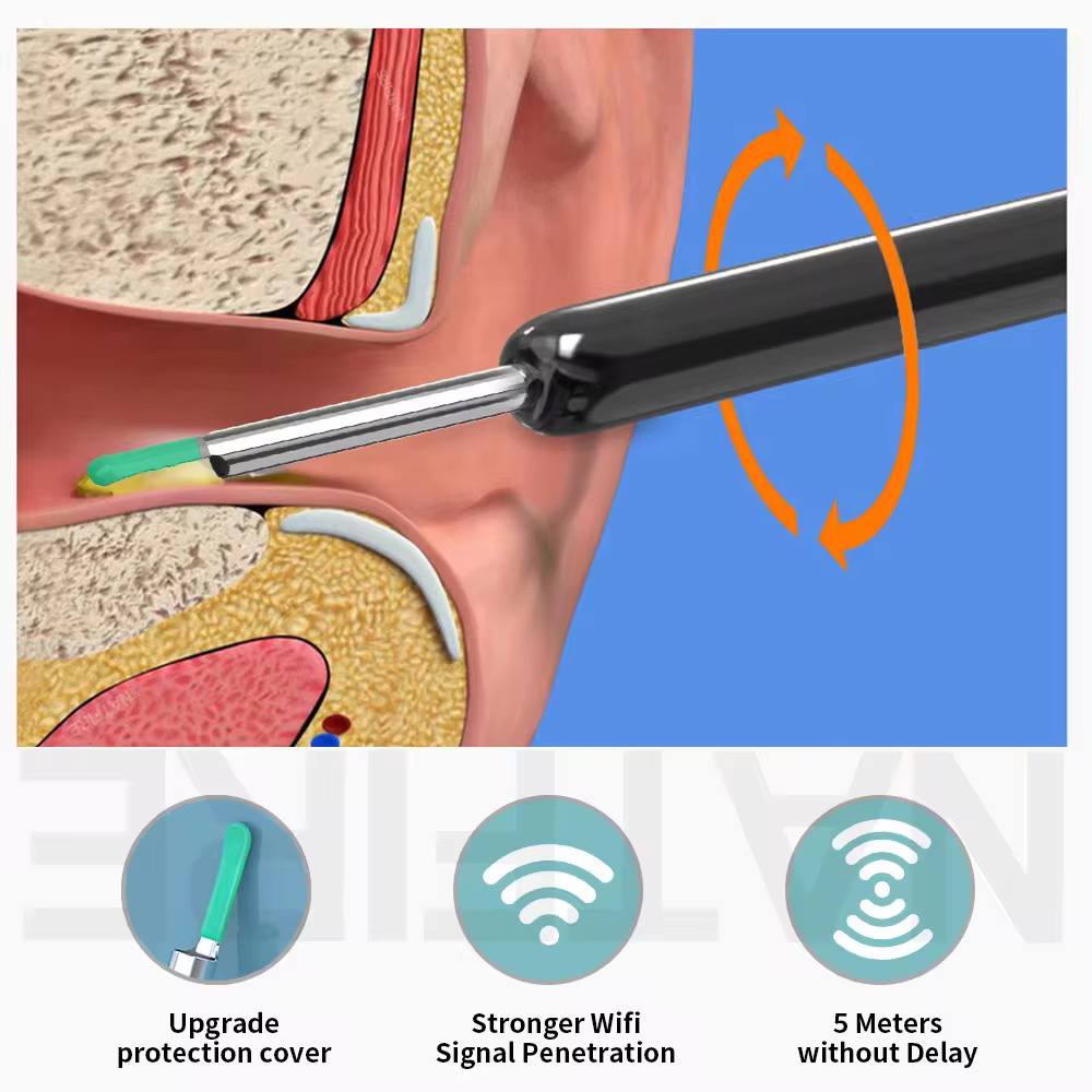 Cure-Oreilles Visuel HD – Nettoyage Précis & Sécurisé